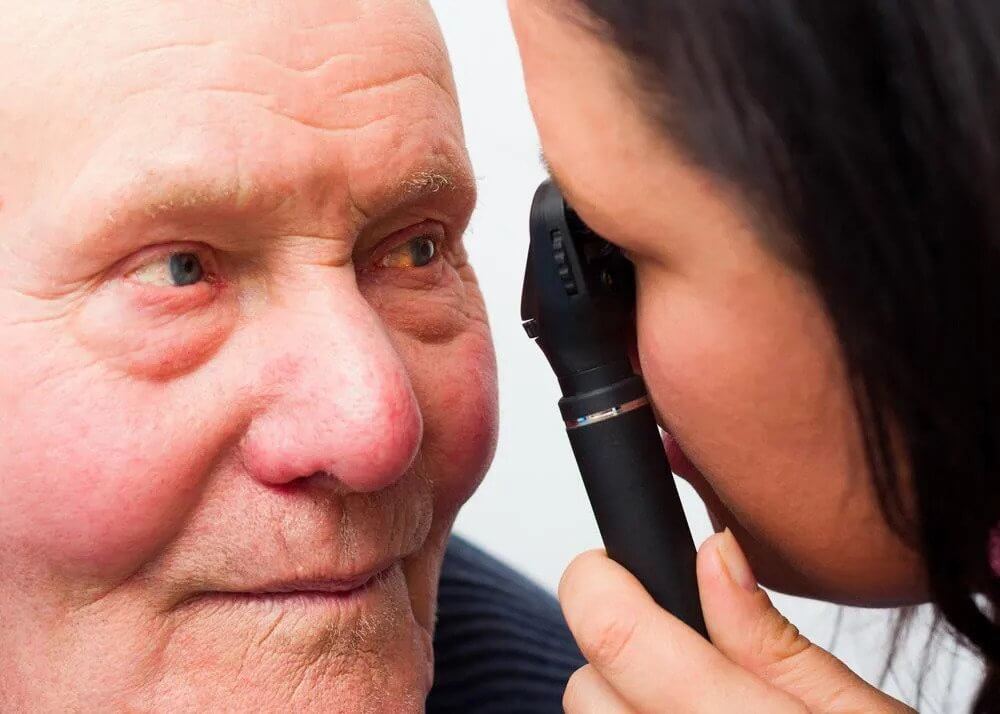 Blepharoplasty
