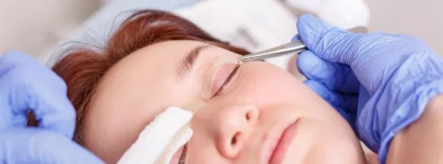 Upper Eye Lid Surgery