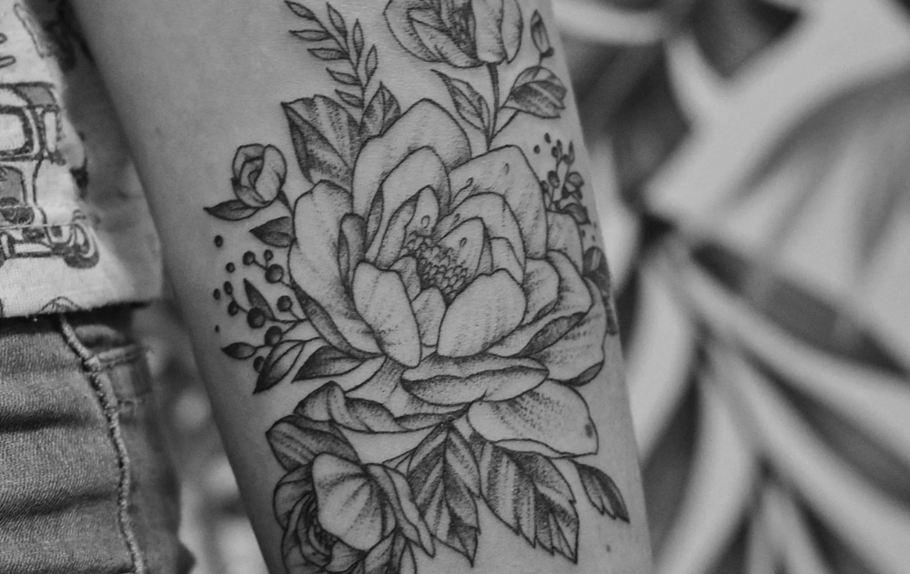 tattoo-removal