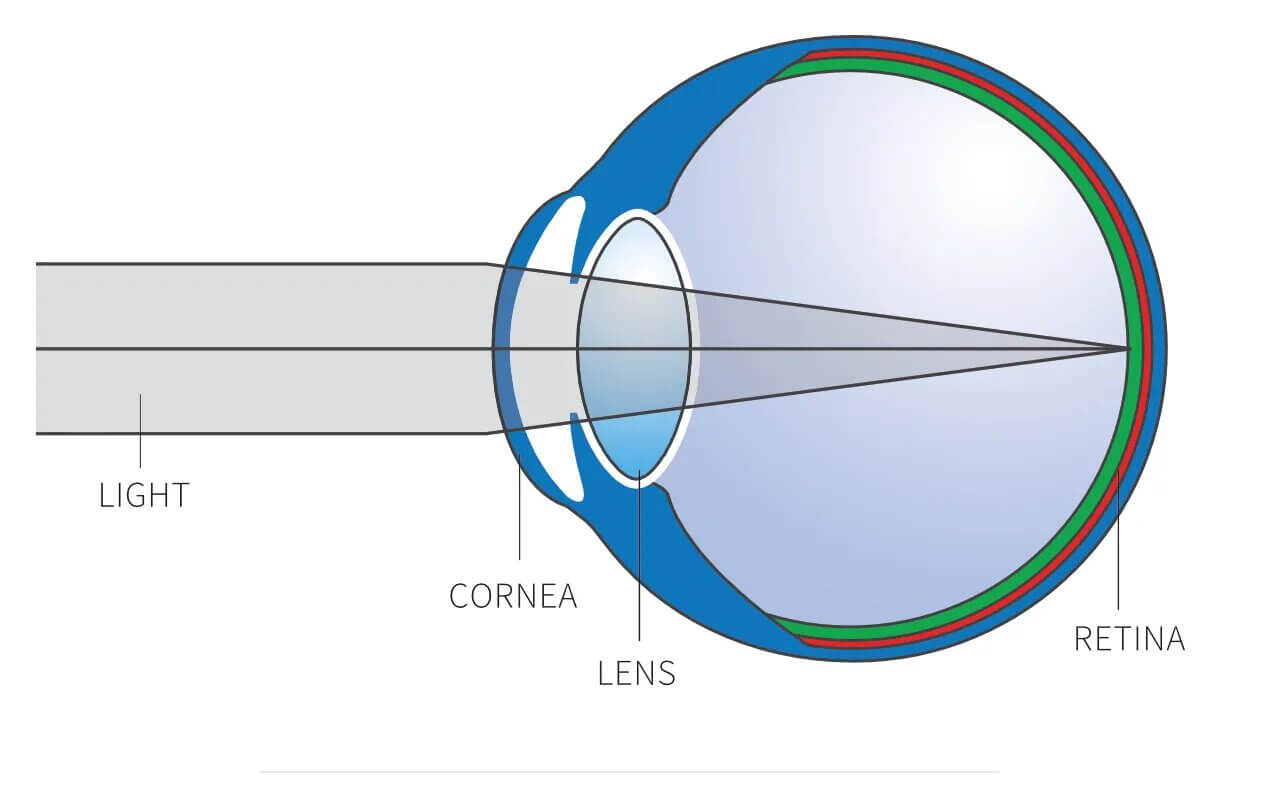 lightrefract