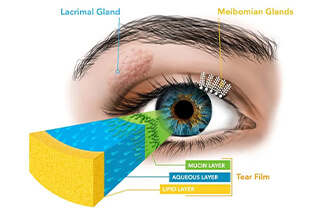 Understanding the Tear Film
